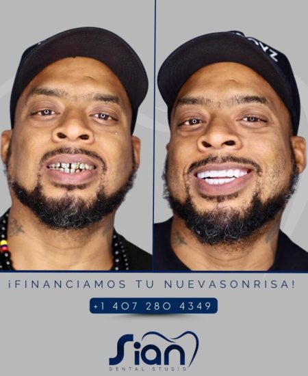 hoy-antes-y-despues-768x960